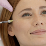 Dermal Filler Appointment Near Potomac MD